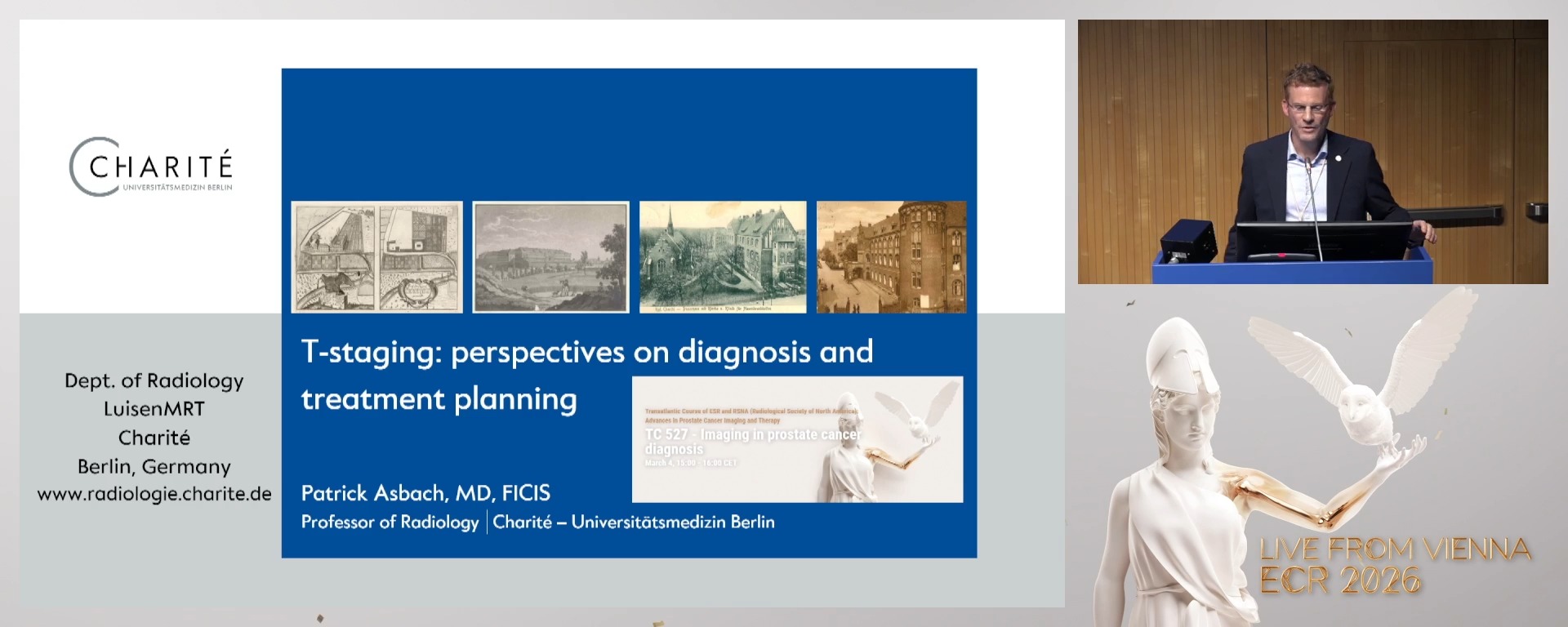 T-staging: perspectives on diagnosis and treatment planning