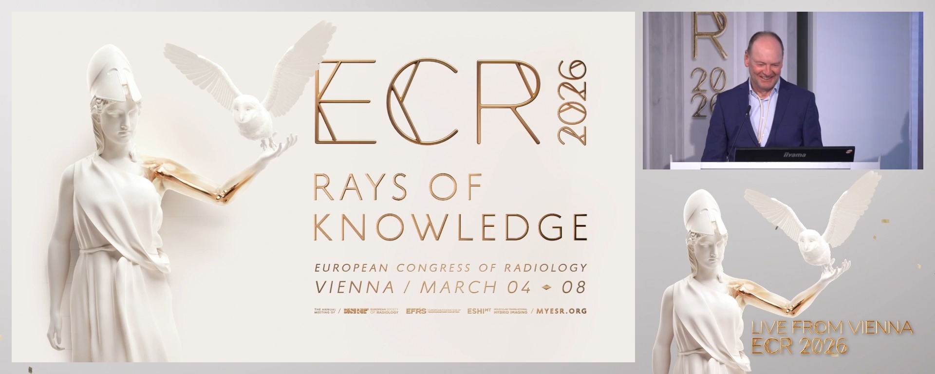 Carotid artery stenting: new studies and new devices