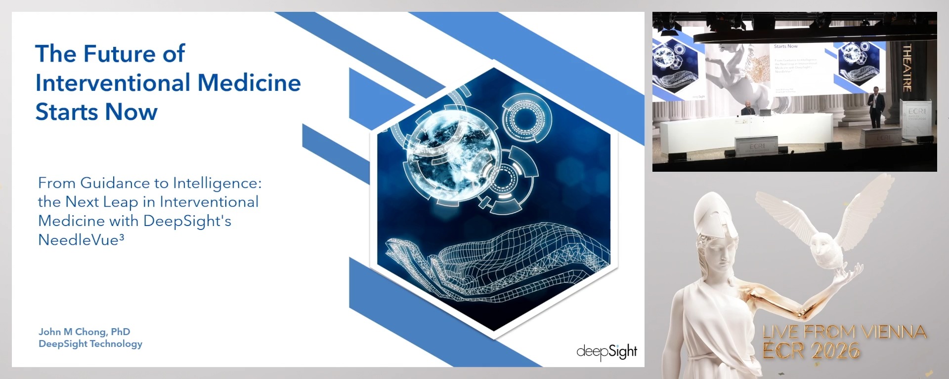 From Guidance to Intelligence: the Next Leap in Interventional Medicine with DeepSight's NeedleVue™