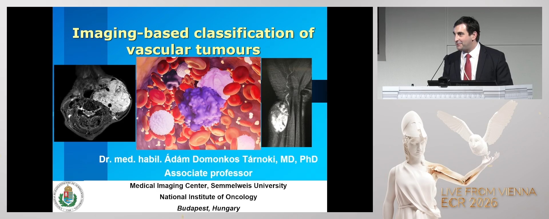 Imaging-based classification of vascular tumours
