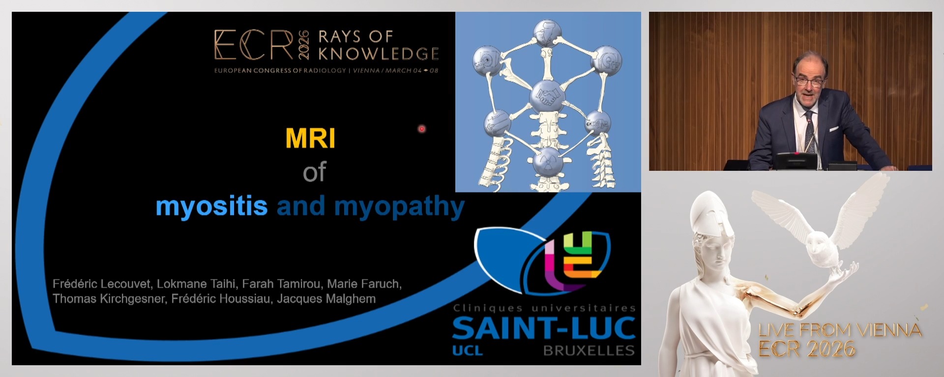 Myositis and myopathy