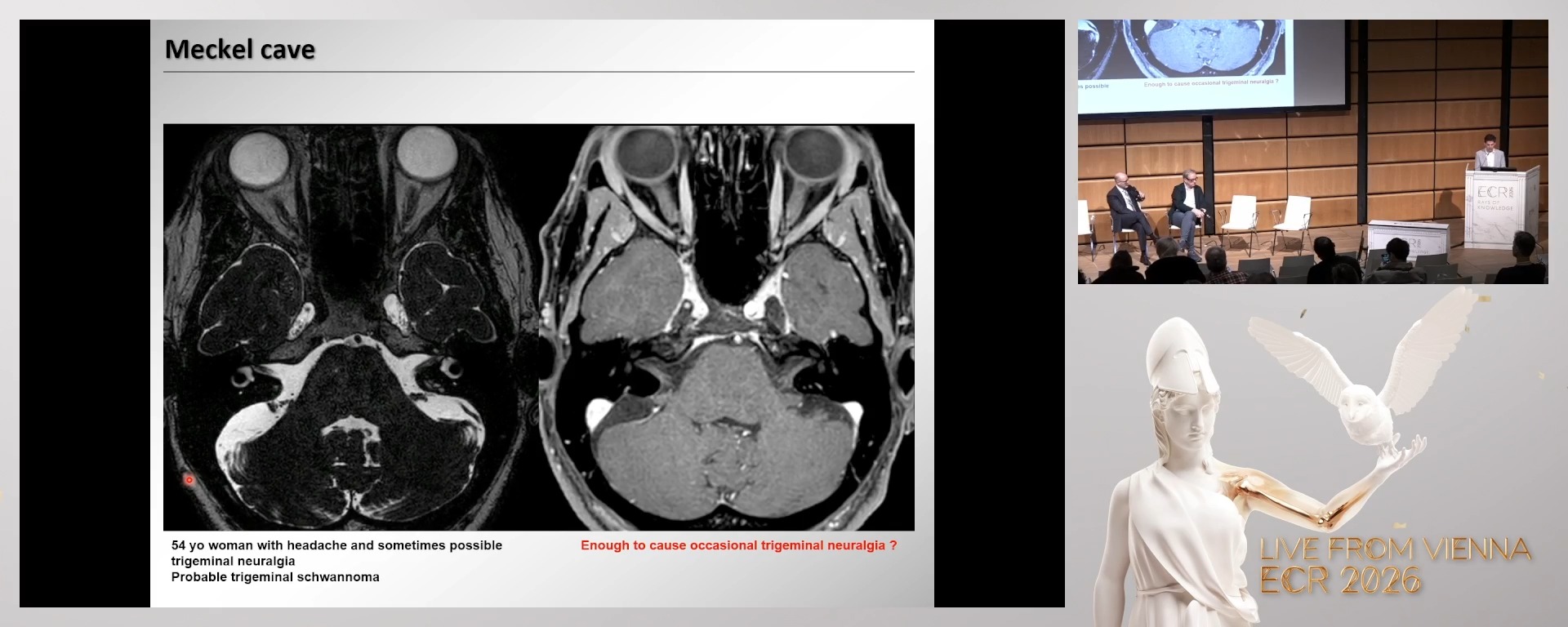 Case-based panel discussion