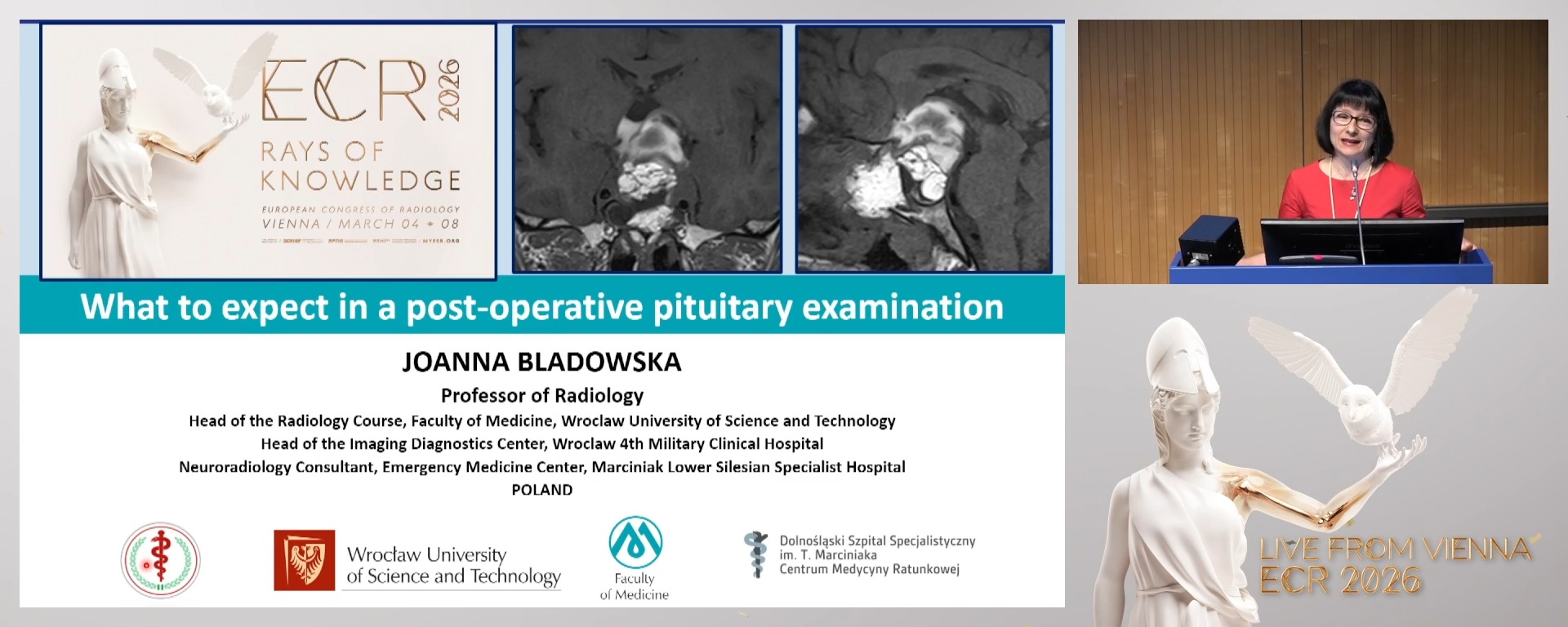 What to expect in a post-operative pituitary examination