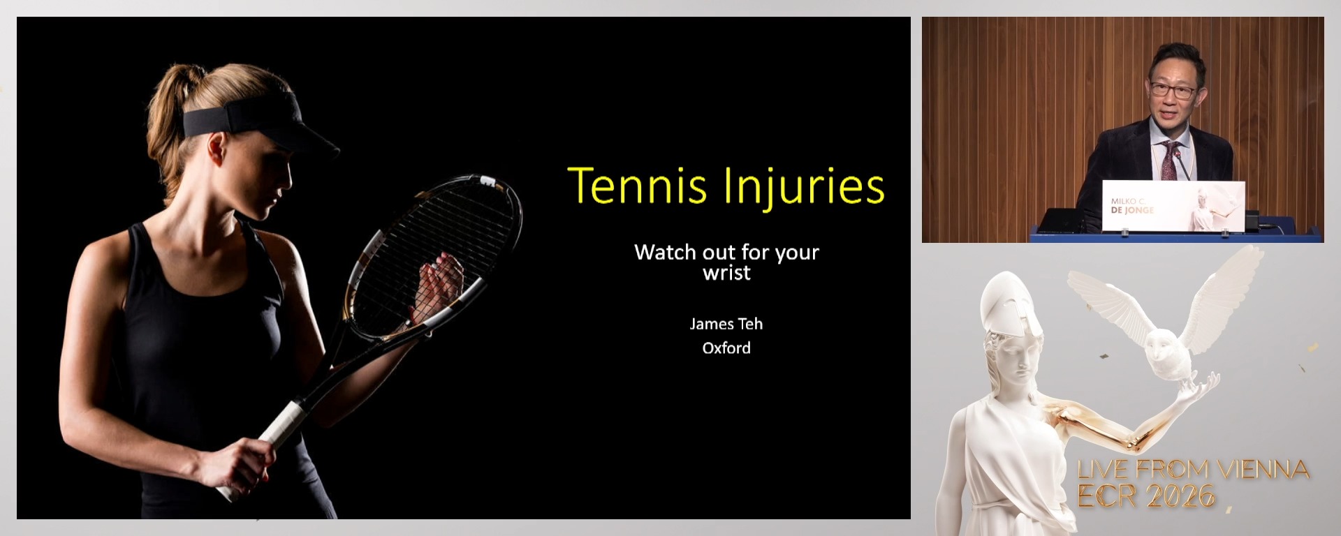 Tennis: watch out for your wrist