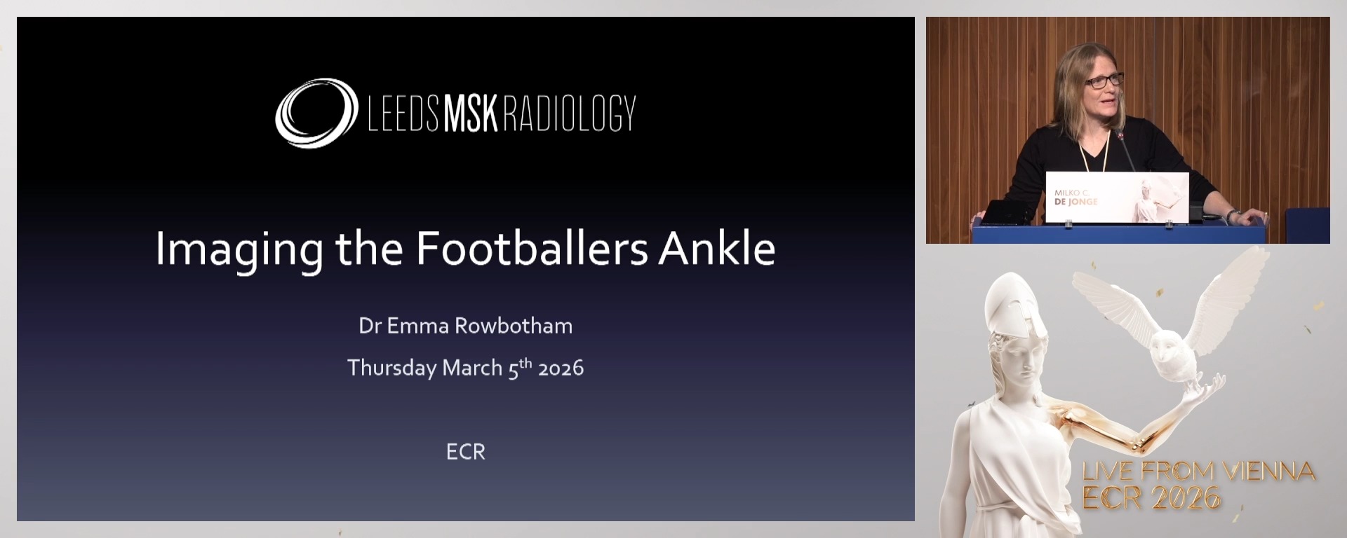 The ankle of the football player