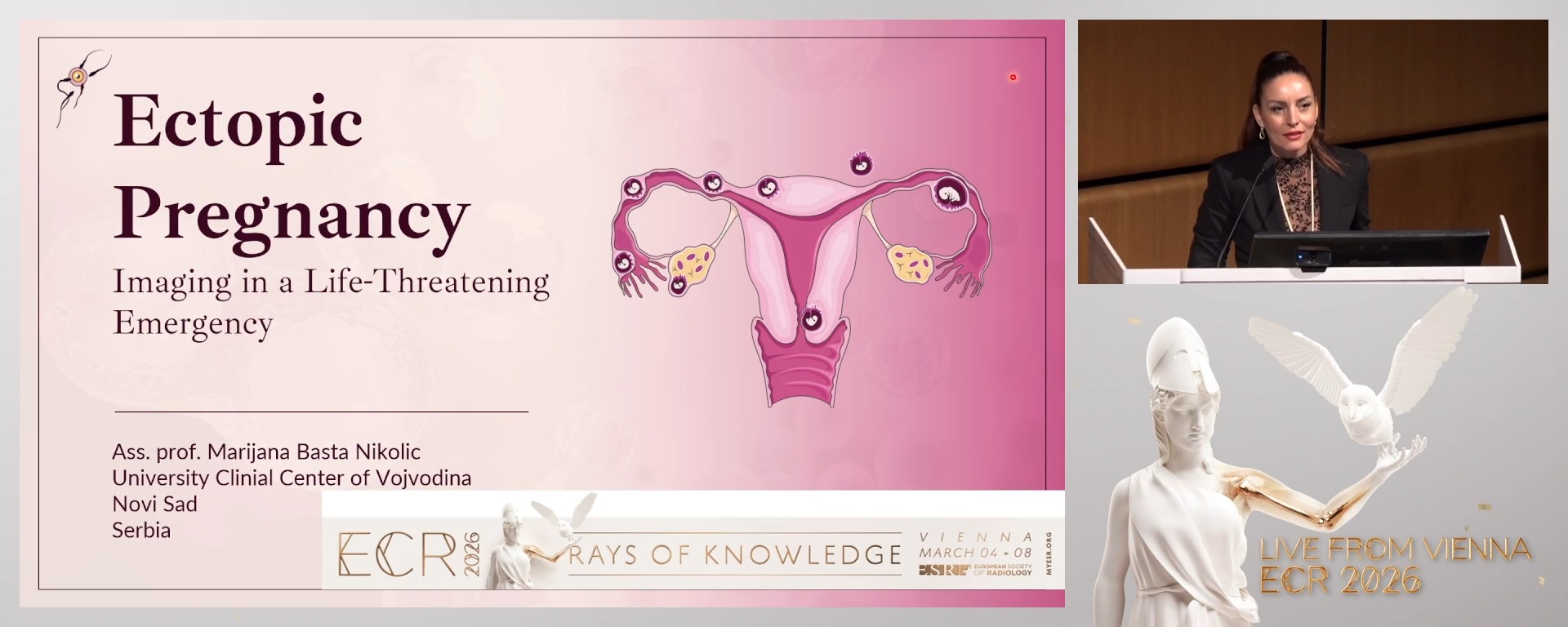 Ectopic pregnancy: imaging in a life-threatening emergency