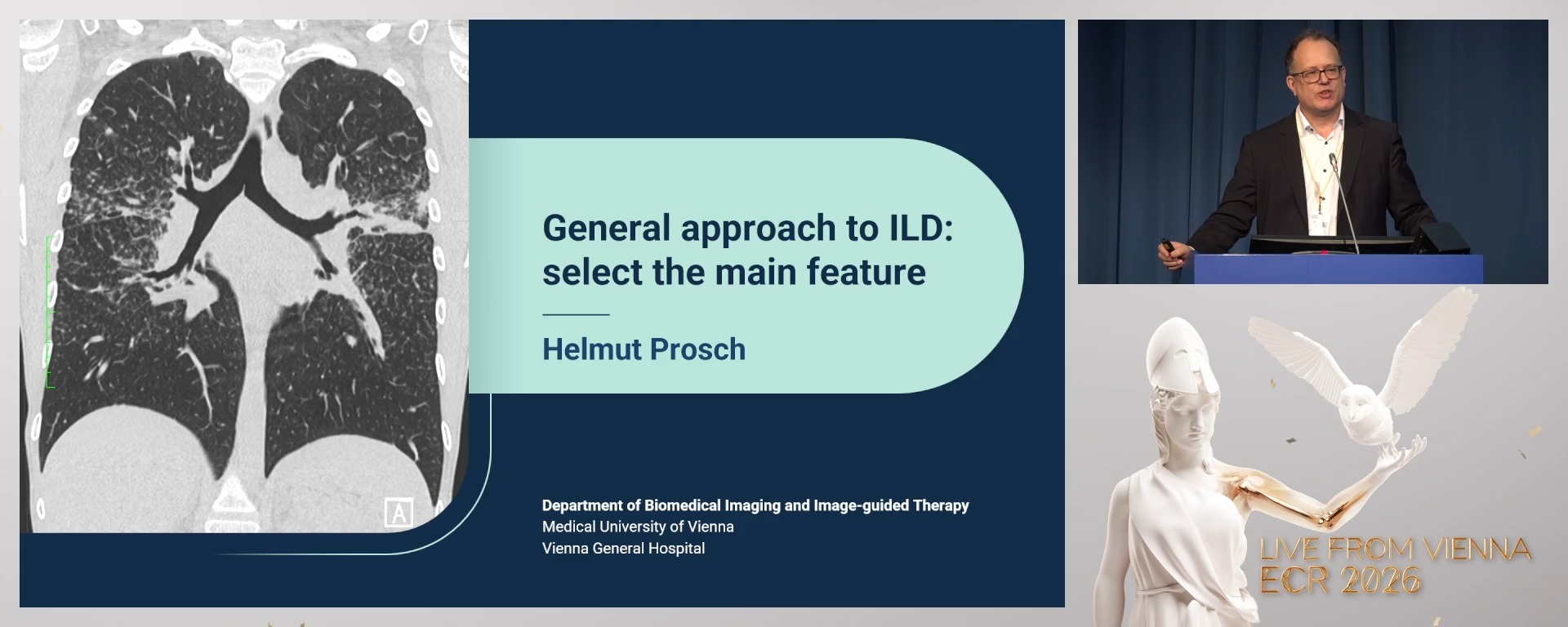 General approach to ILD: select the main feature!