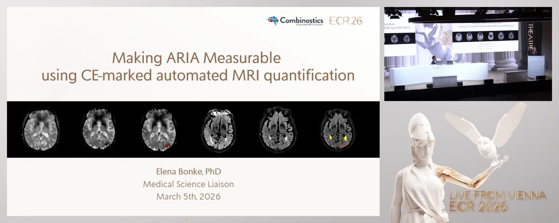 Making ARIA Measurable using CE-marked automated MRI quantification