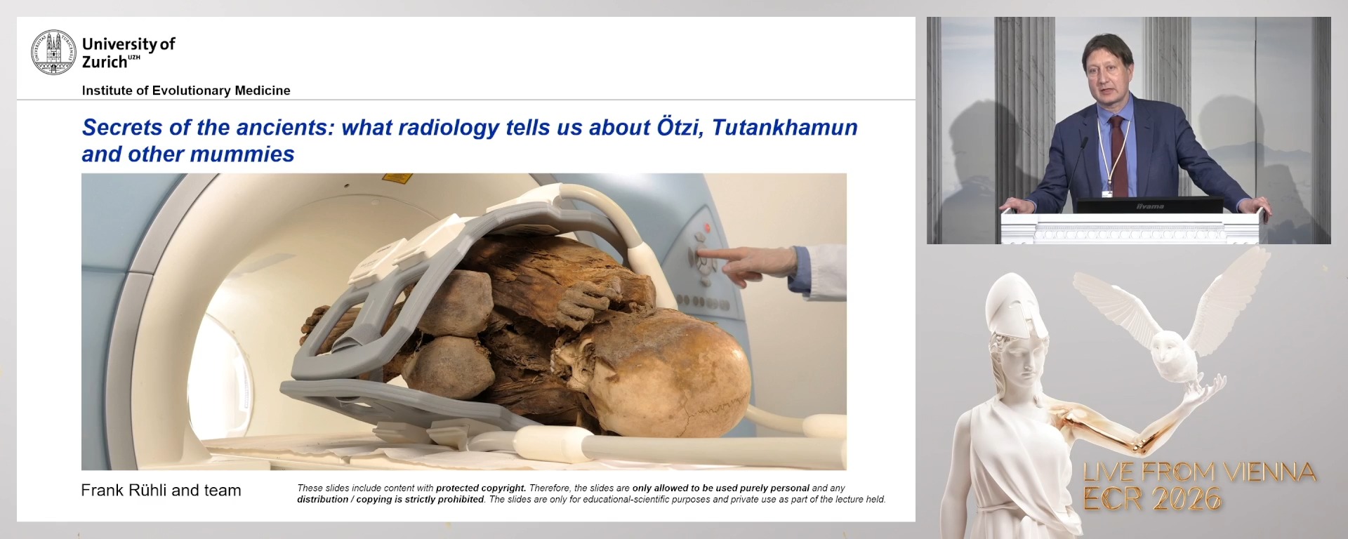 Secrets of the ancients: what radiology tells us about Ötzi, Tutankhamen and other mummies