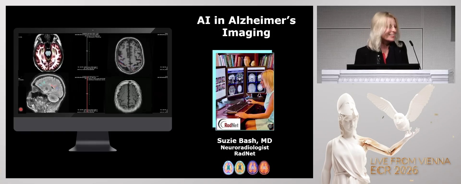 AI in Alzheimer's Imaging