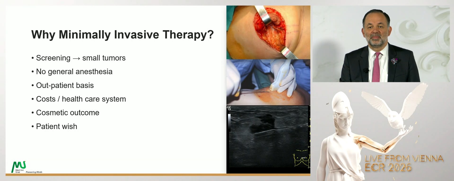 Minimally invasive cryoablation:where do we stand today?