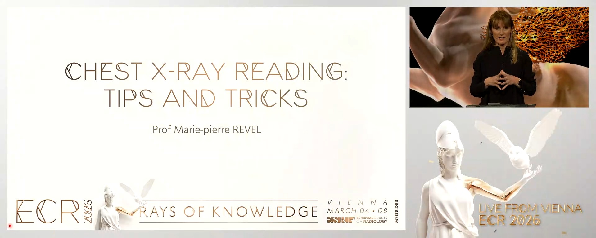 Chest x-ray reading: tips and tricks