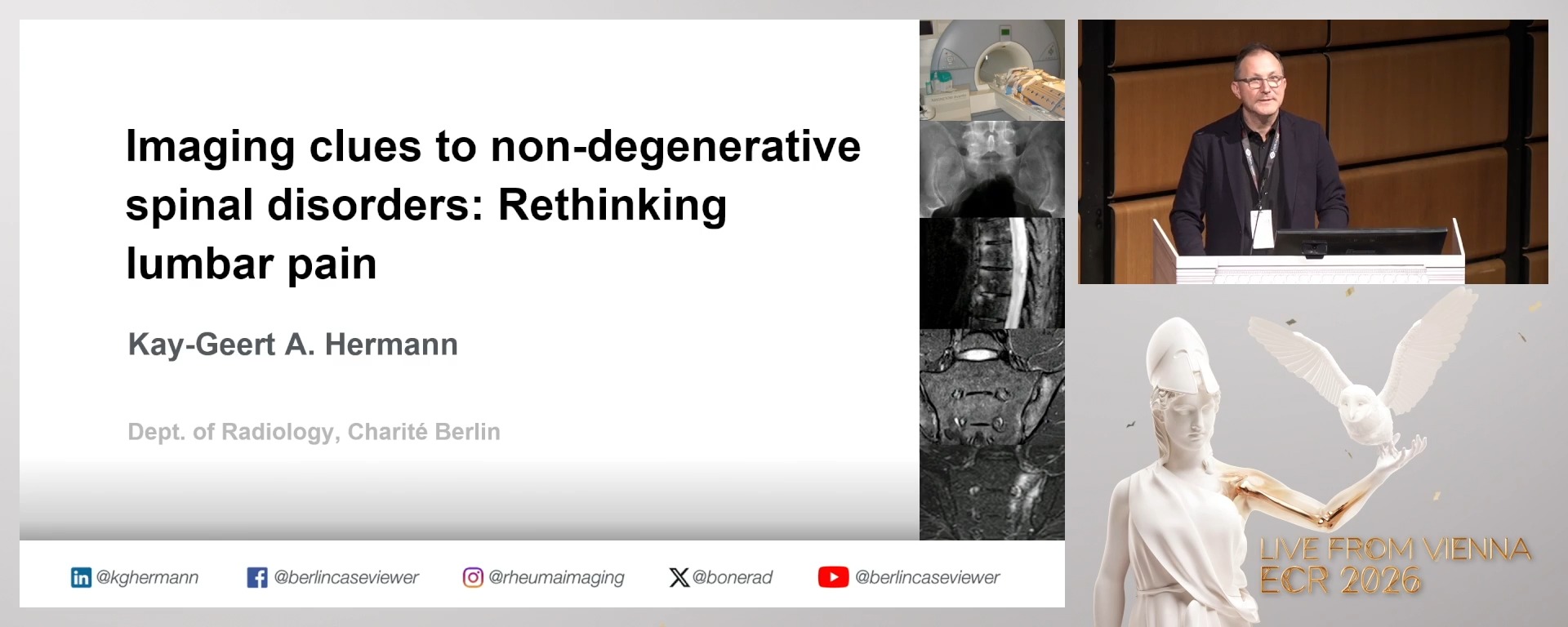 Imaging clues to non-degenerative spinal disorders: rethinking lumbar pain