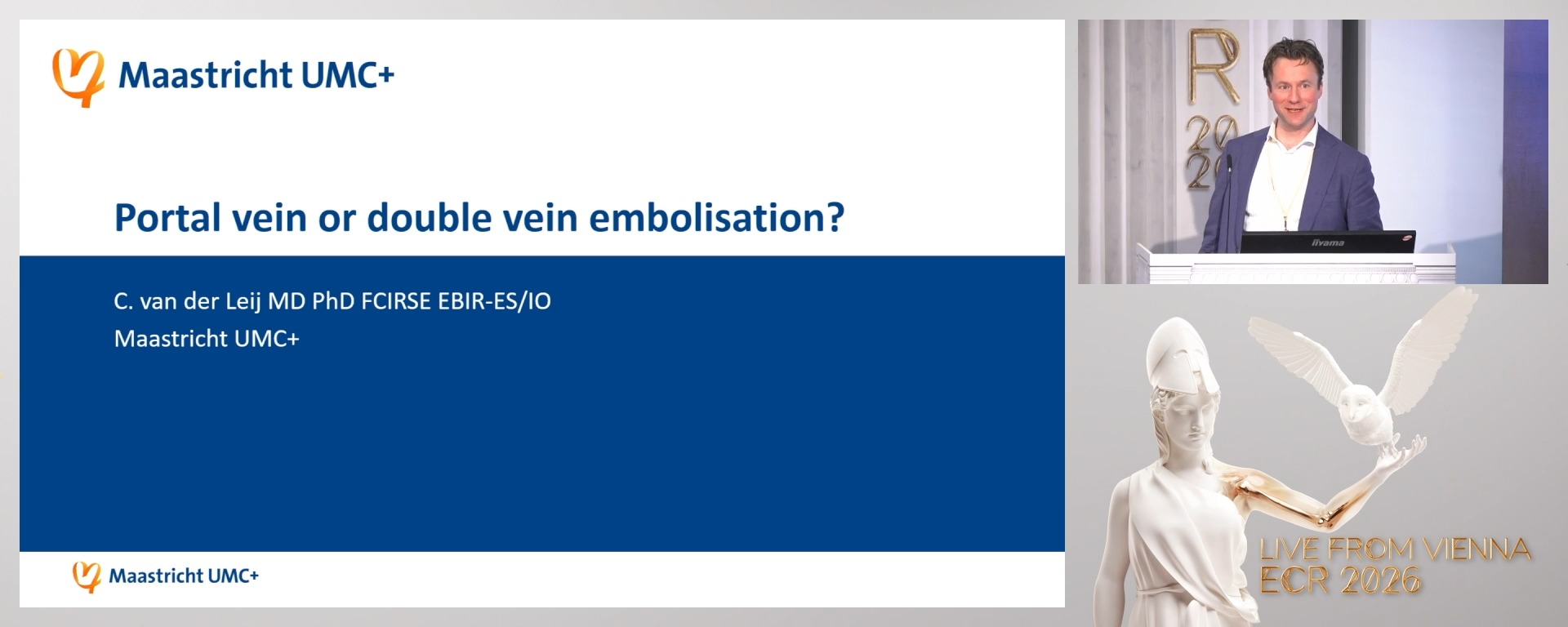 Portal vein or double vein embolisation