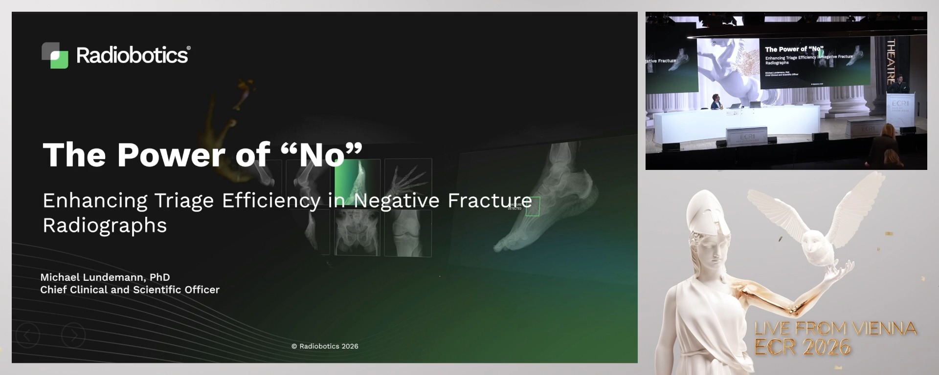 The Power of “No”: Enhancing Triage Efficiency in Negative Fracture Radiographs