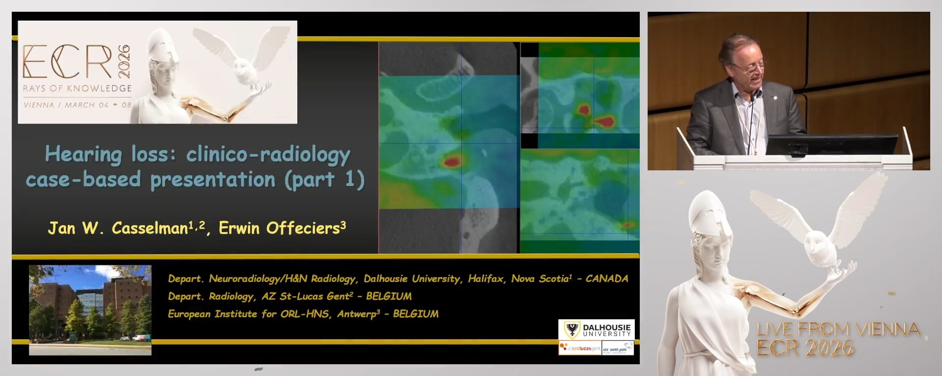 Hearing loss: clinico-radiology case-based presentations (part I)
