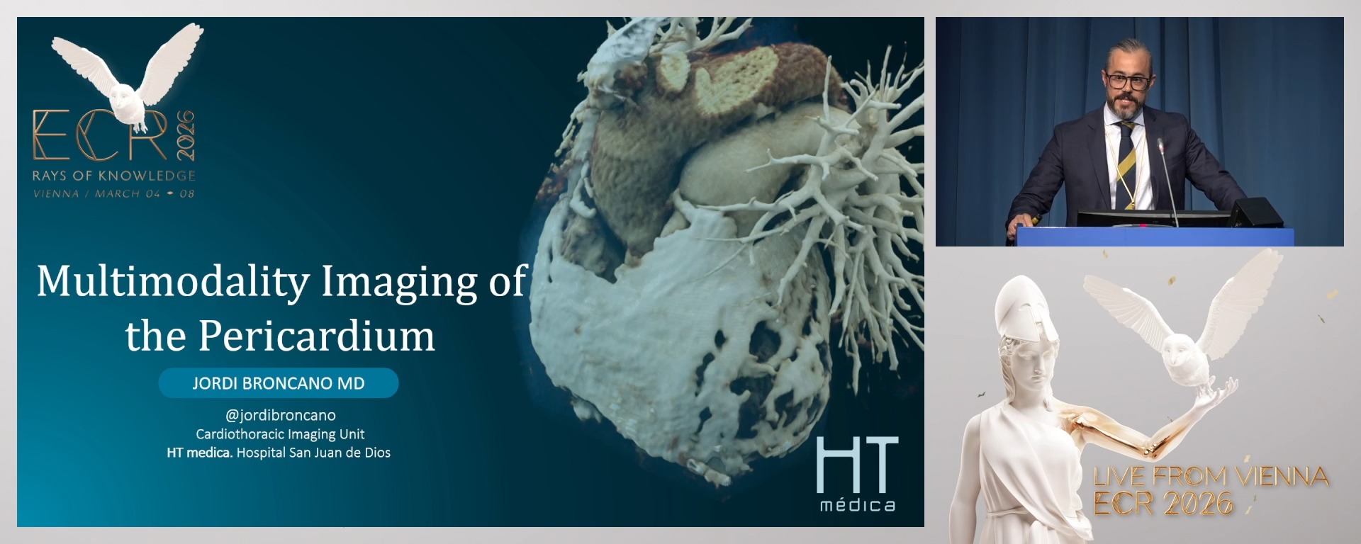 Imaging in pericardial disease