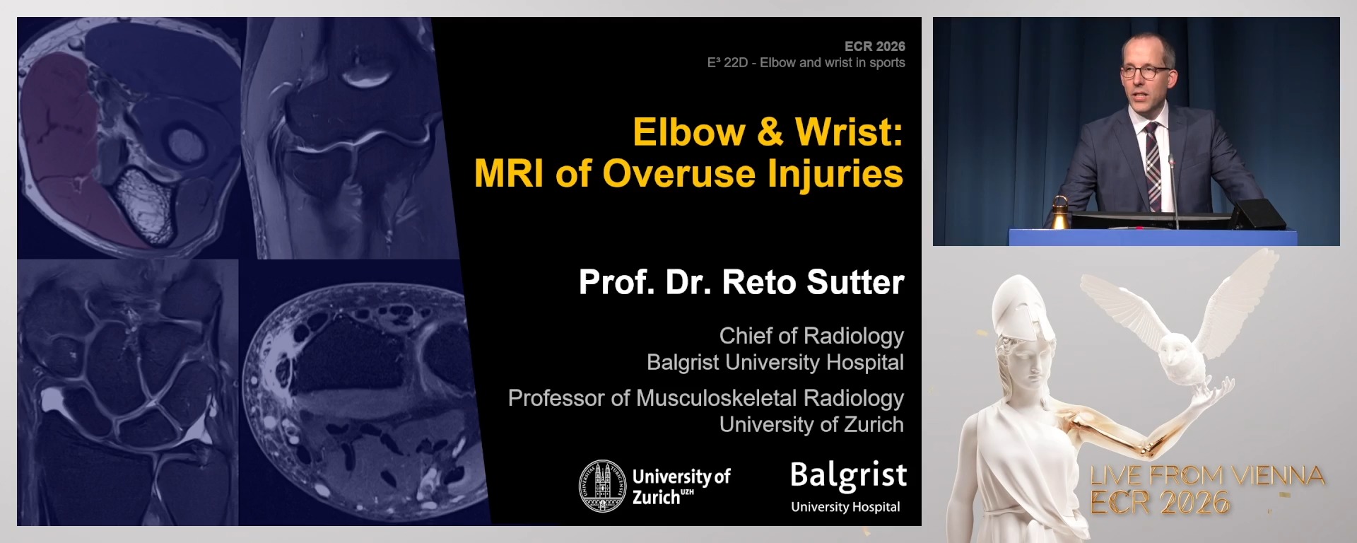 MRI of overuse injuries