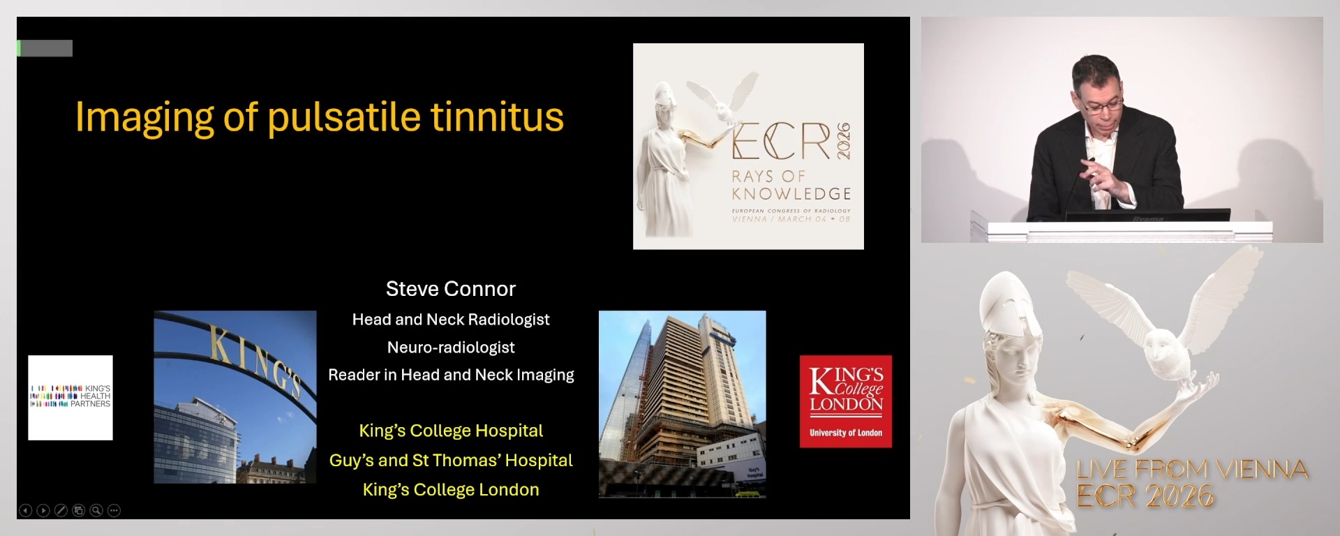 Imaging of pulsatile tinnitus