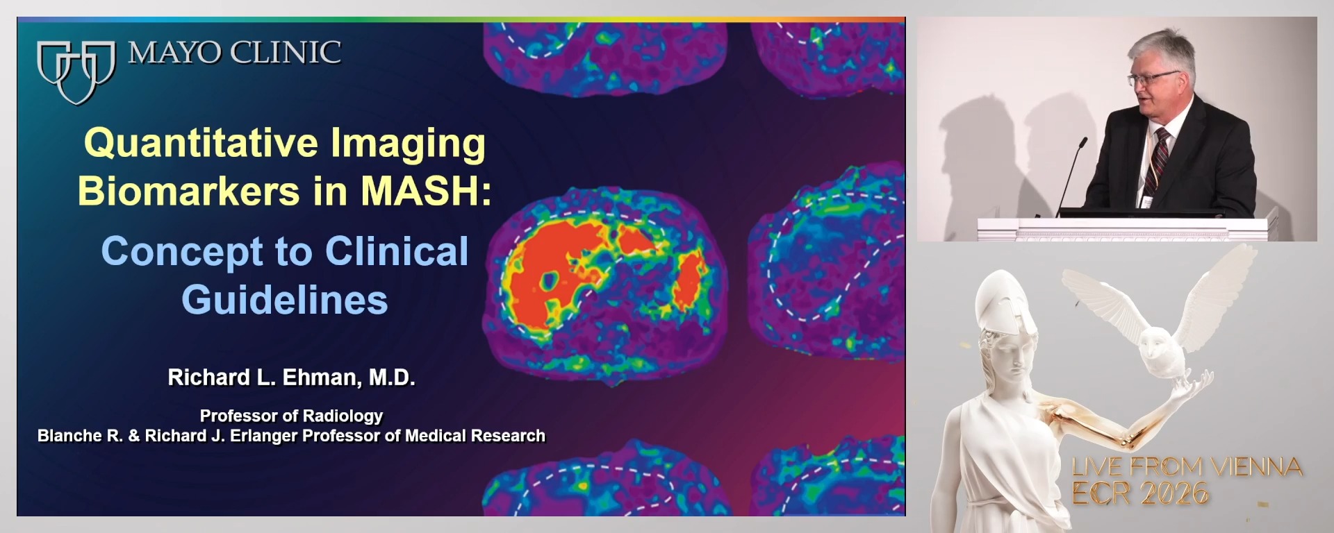 Quantitative imaging biomarkers in MASH: from concept to clinical criteria