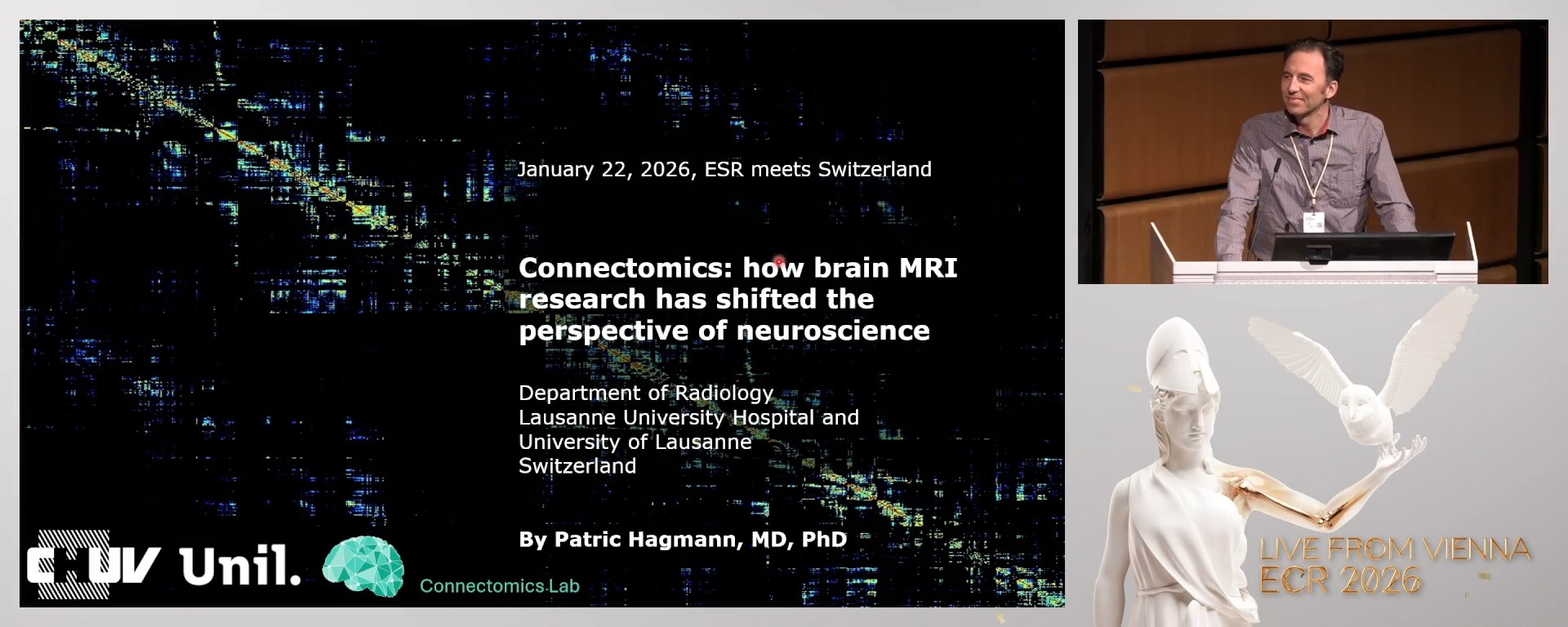 Connectomics: how brain MRI research has shifted the perspective of neurosciences