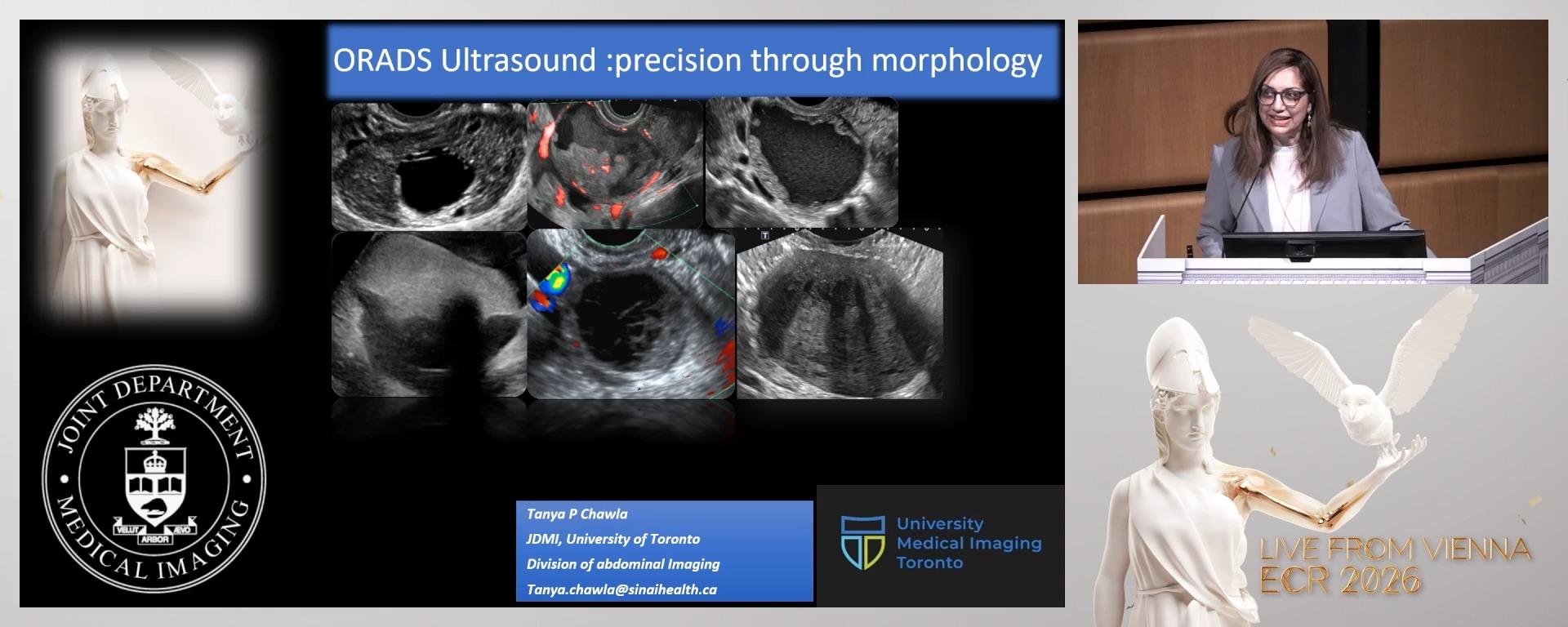 US ovarian-adnexal reporting and data system (O-RADS)