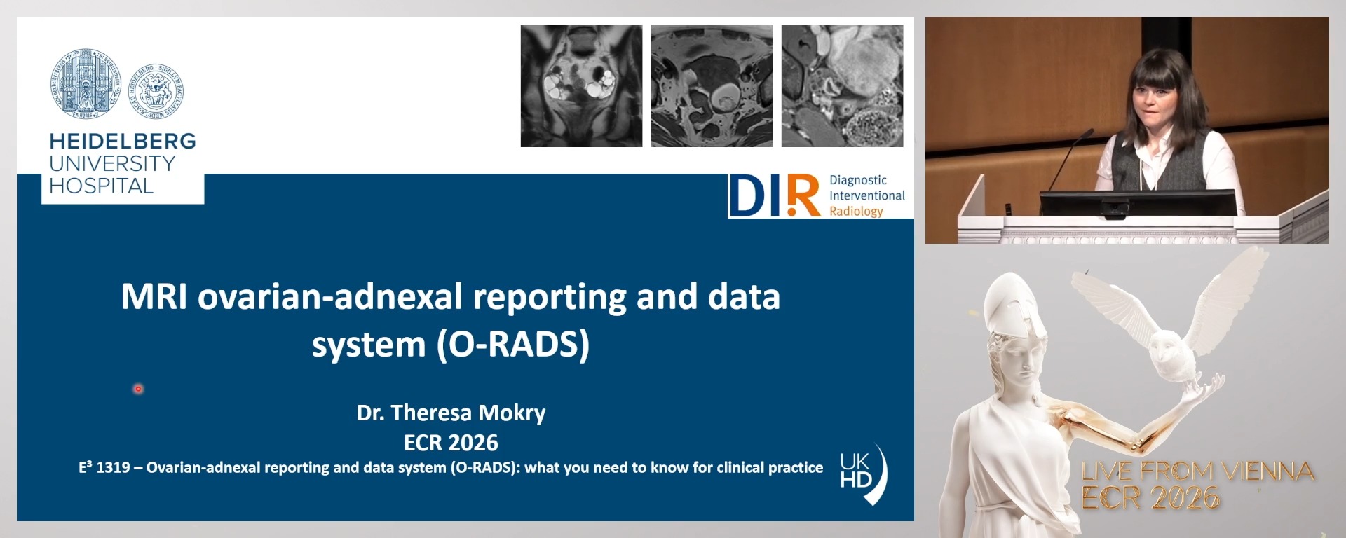 MRI ovarian-adnexal reporting and data system (O-RADS)