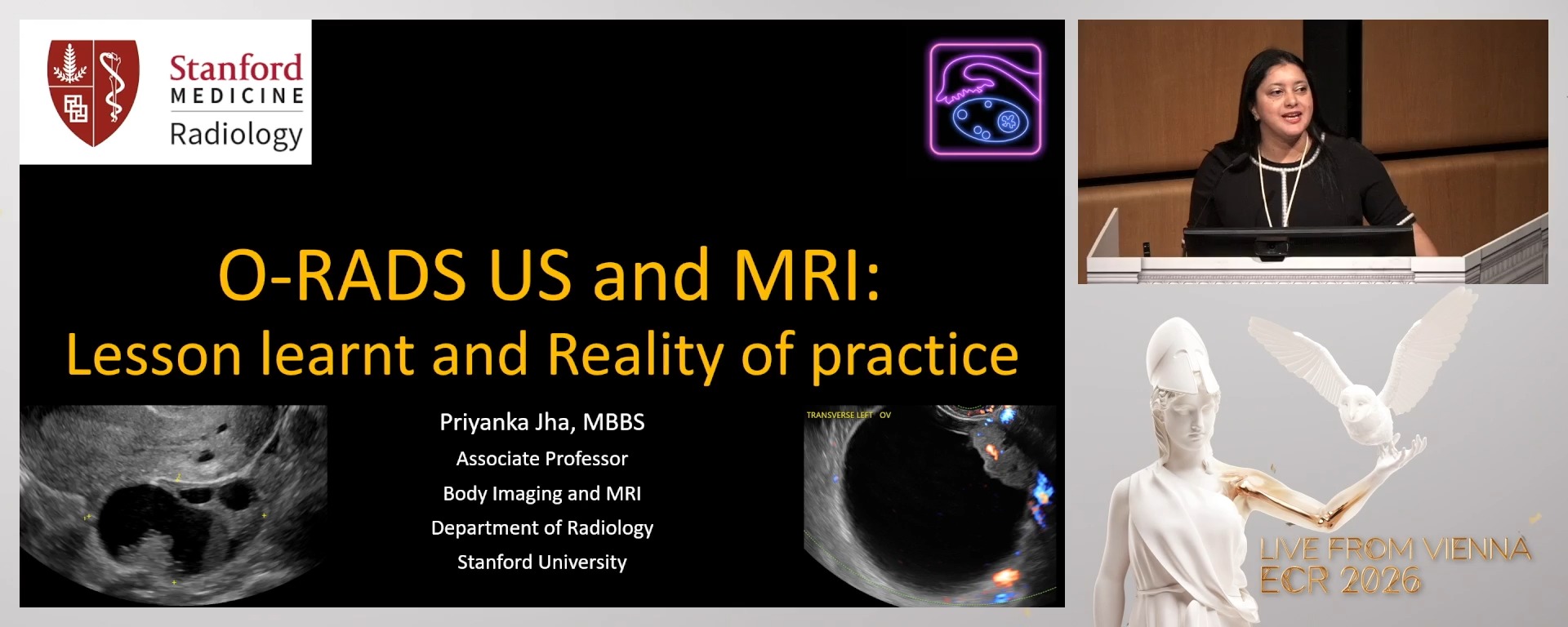 Ovarian-adnexal reporting and data system (O-RADS): lessons learnt and the reality of practice