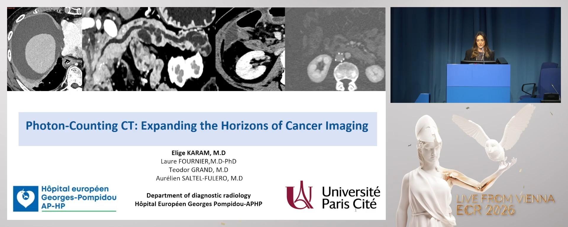 Photon-counting CT in oncology