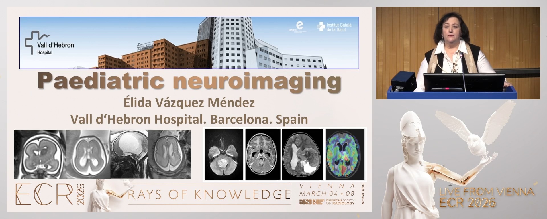 Paediatric neuroimaging