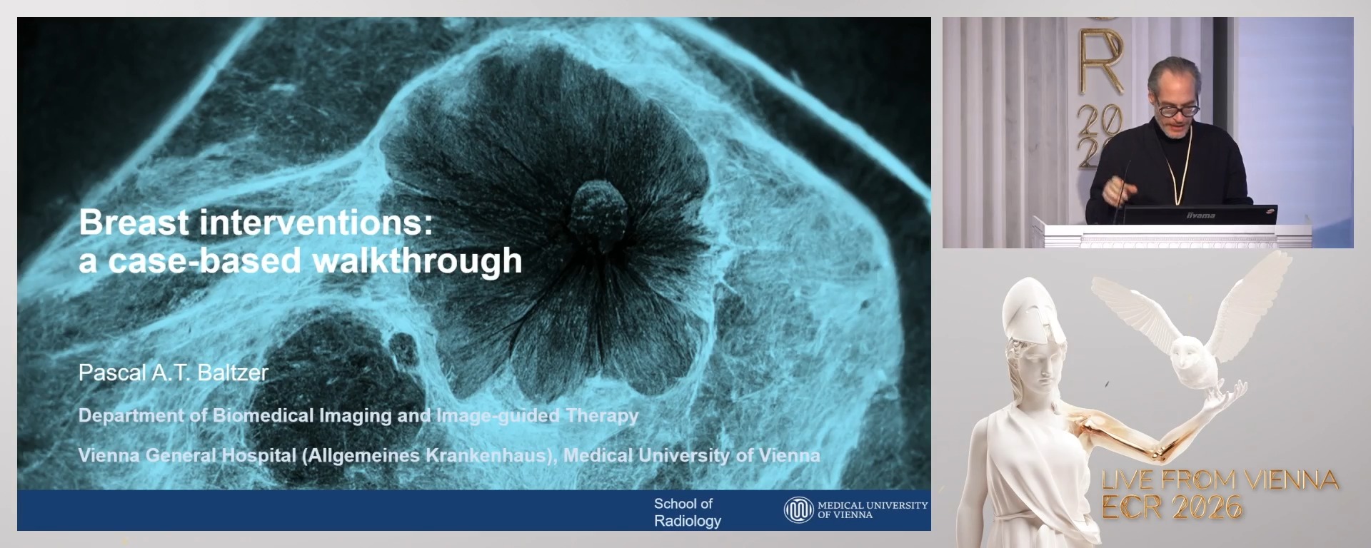 Breast interventions: a case-based walkthrough