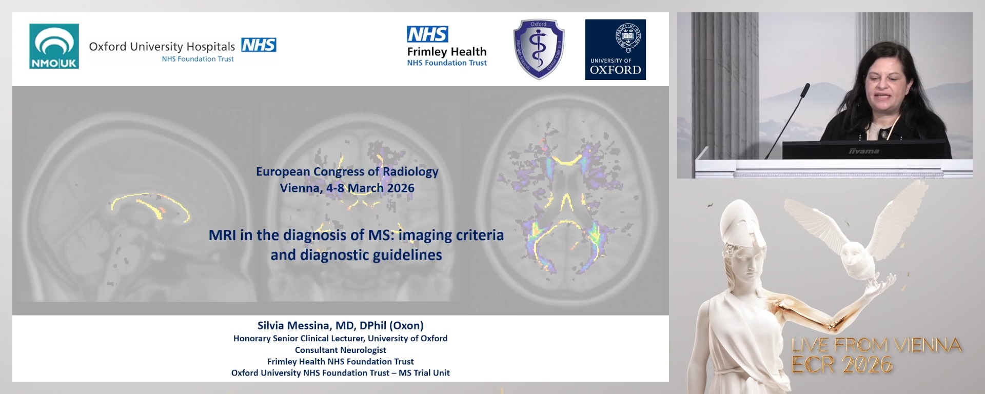MRI in the diagnosis of MS: imaging criteria and diagnostic guidelines