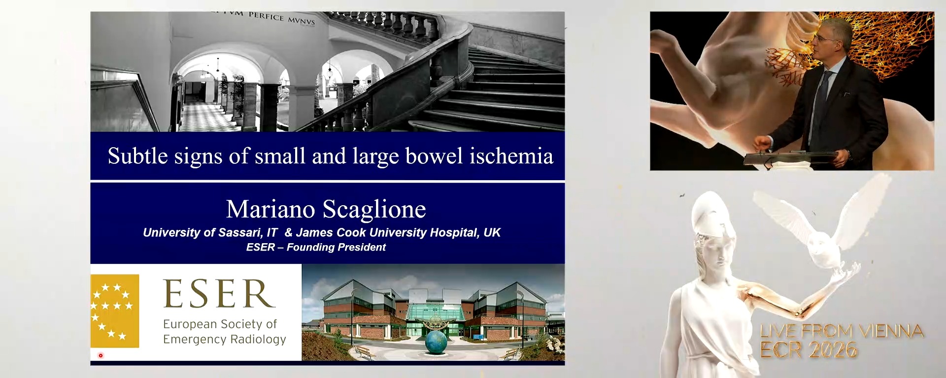 Abdomen: subtle signs of small and large bowel ischaemia