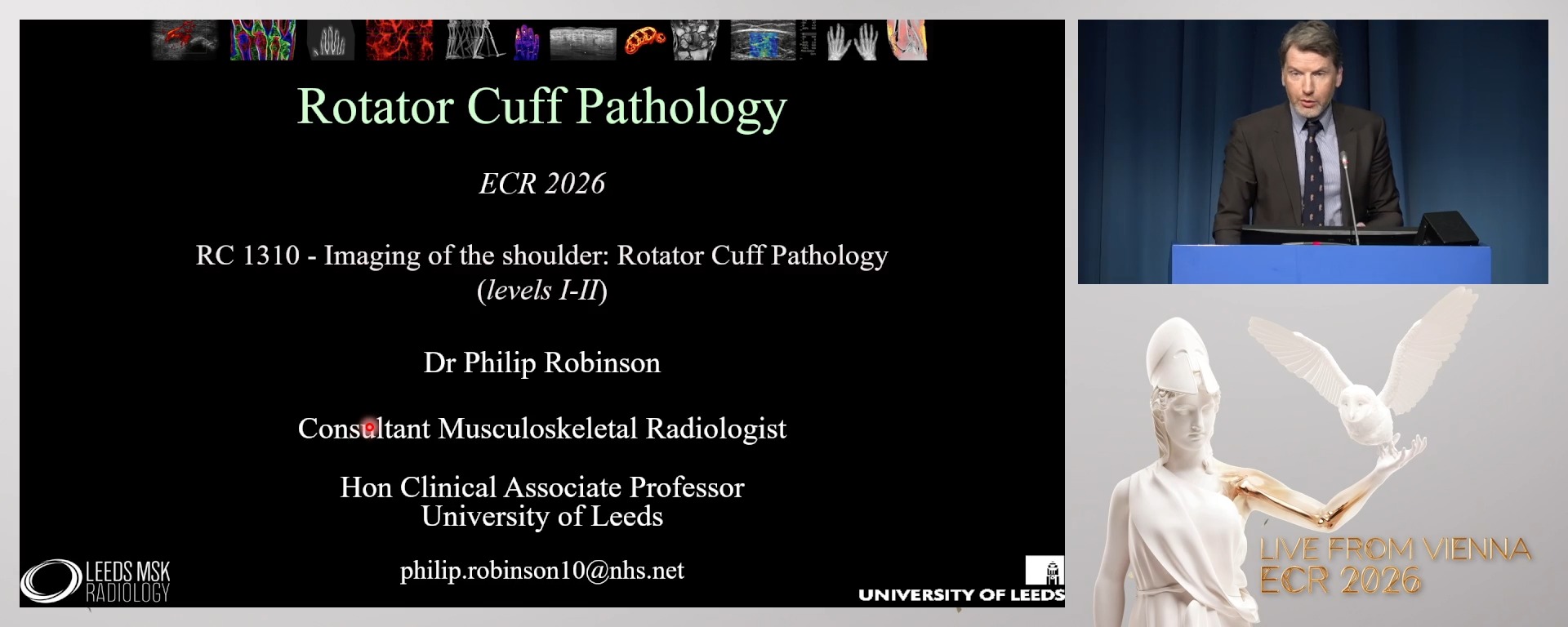 Rotator cuff pathology