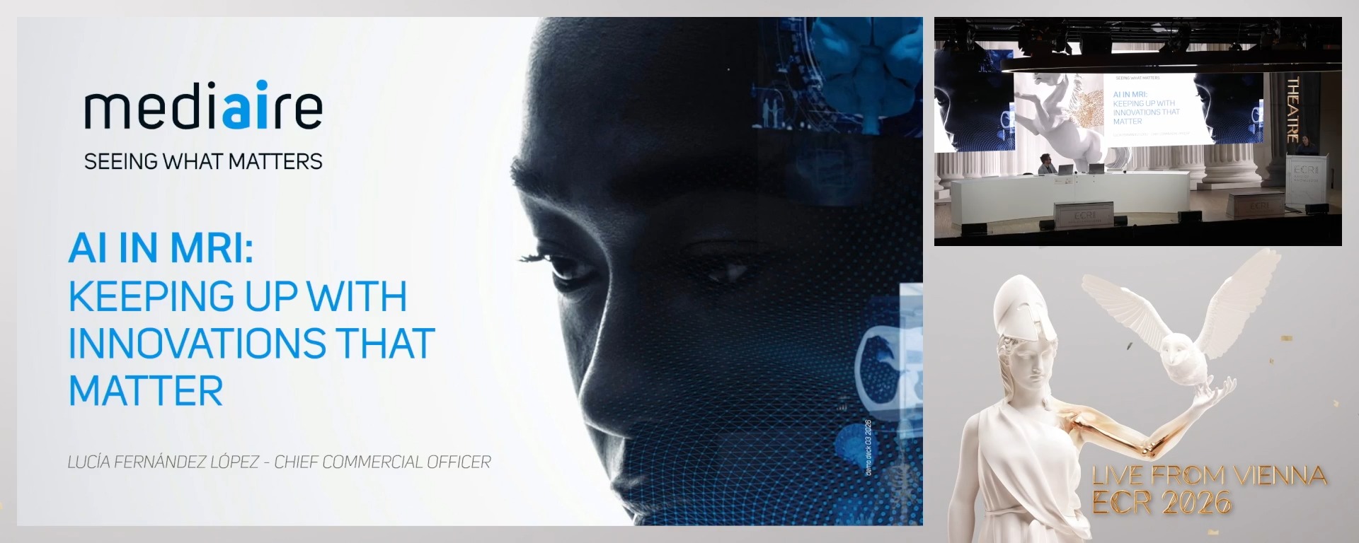 AI in MRI: Keeping up with innovations that matter