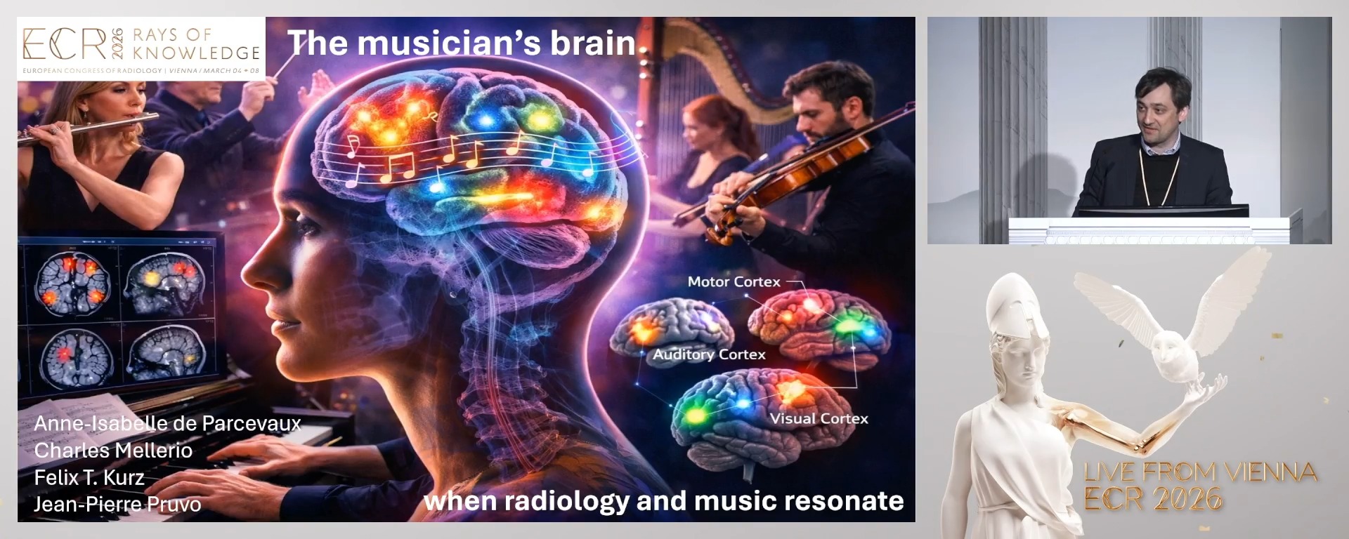 The musician's brain: when radiology and music resonate!