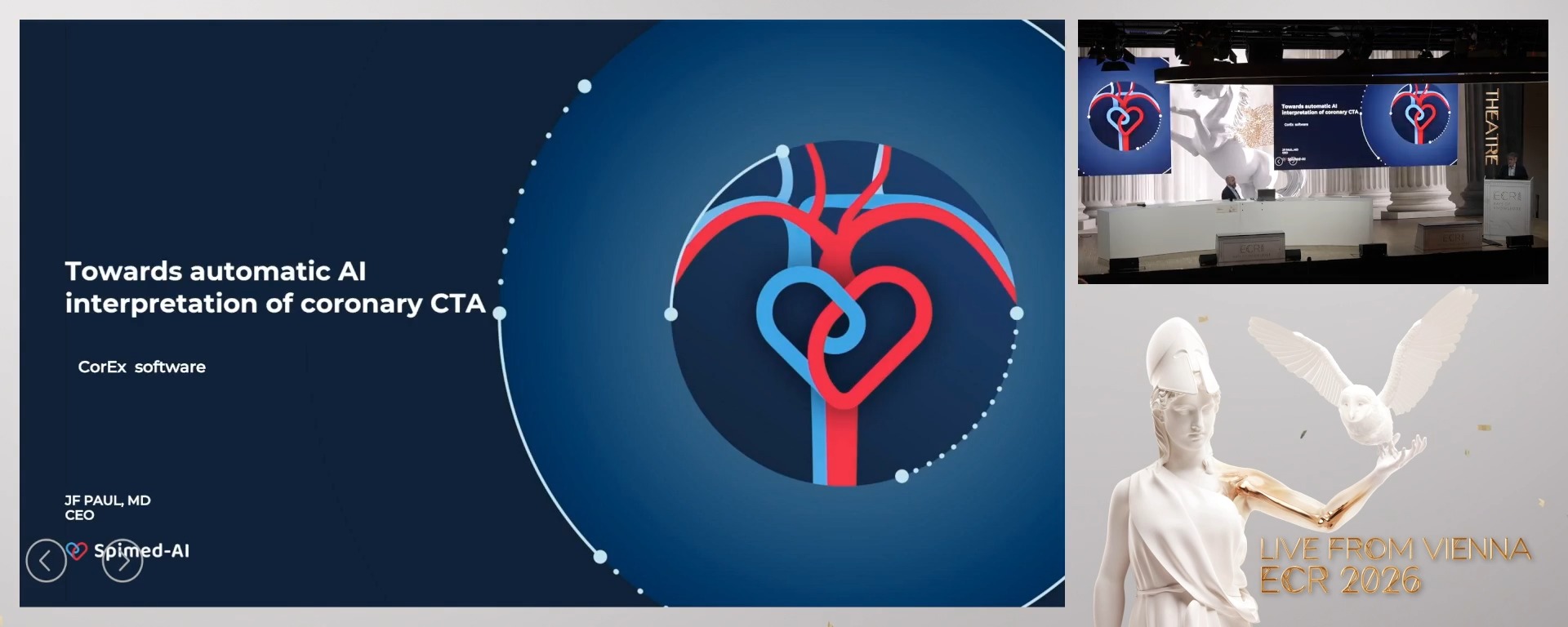 Towards automated interpretation of Coronary CT Scans