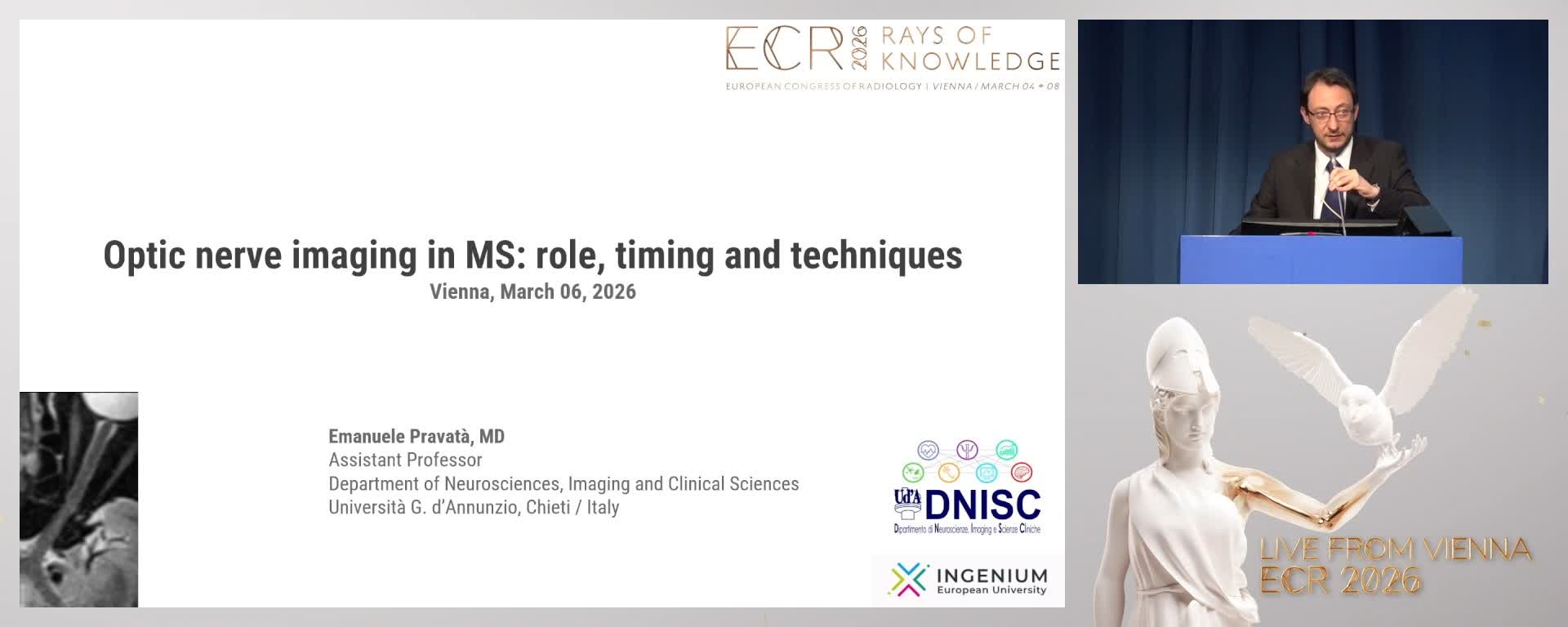 Optic nerve imaging in MS: role, timing and techniques