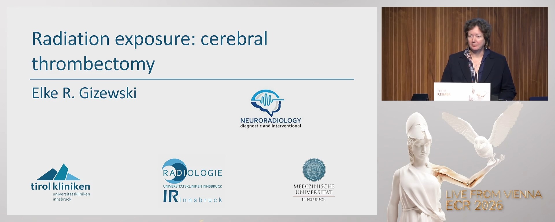 Radiation exposure: cerebral thrombectomy