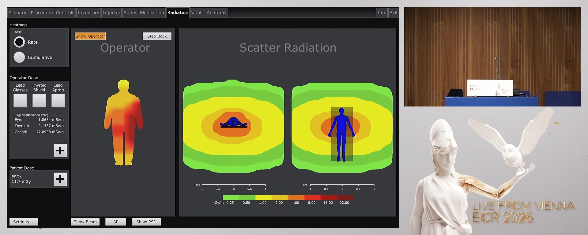 Radiation exposure: TACE and pelvic embolisation