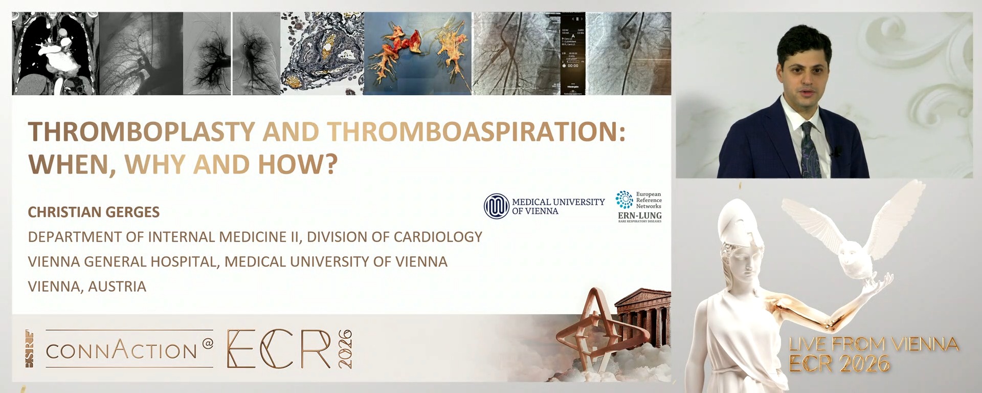 Thromboplasty and thromboaspiration: when, why, and how?