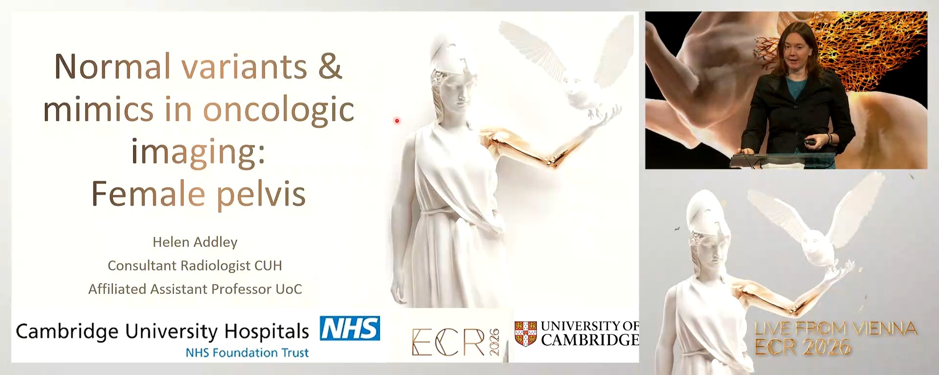 Female pelvis imaging