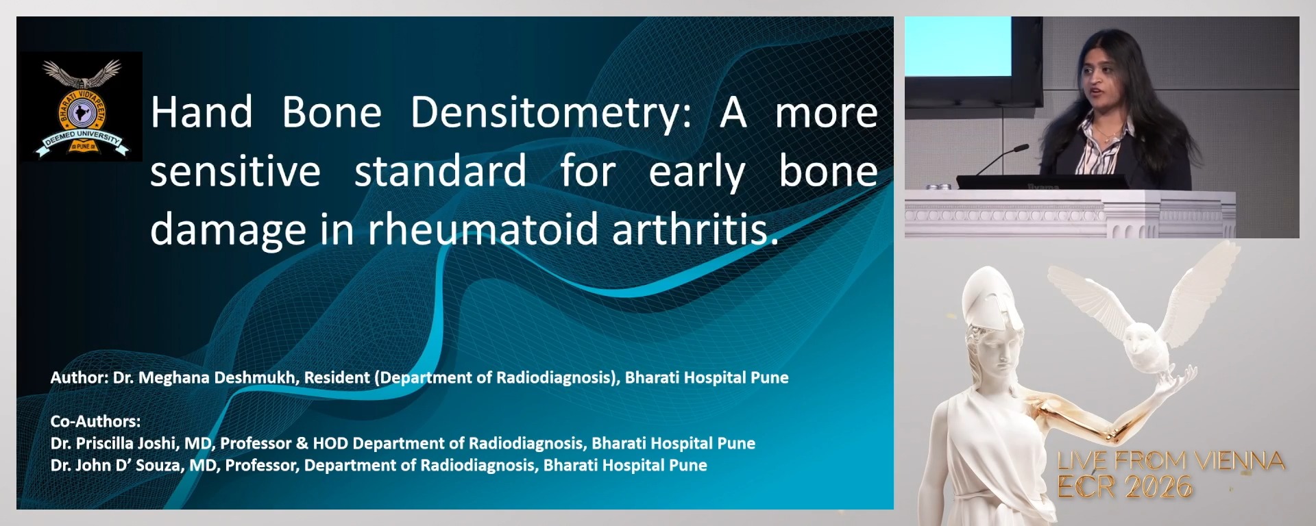 Hand bone densitometry: a more sensitive standard for the early bone damage in rheumatoid arthritis