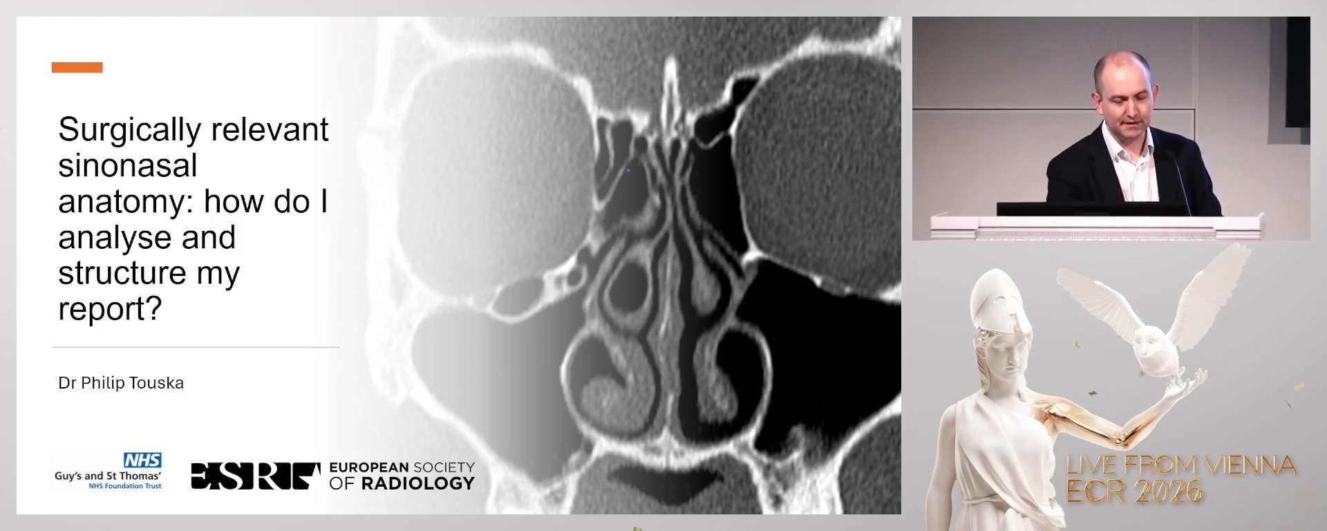 Surgically relevant sinonasal anatomy: how do I analyse and structure my report?