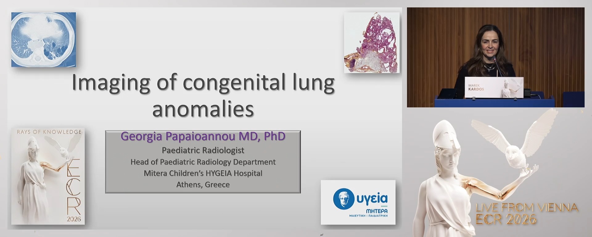 Imaging of congenital lung anomalies