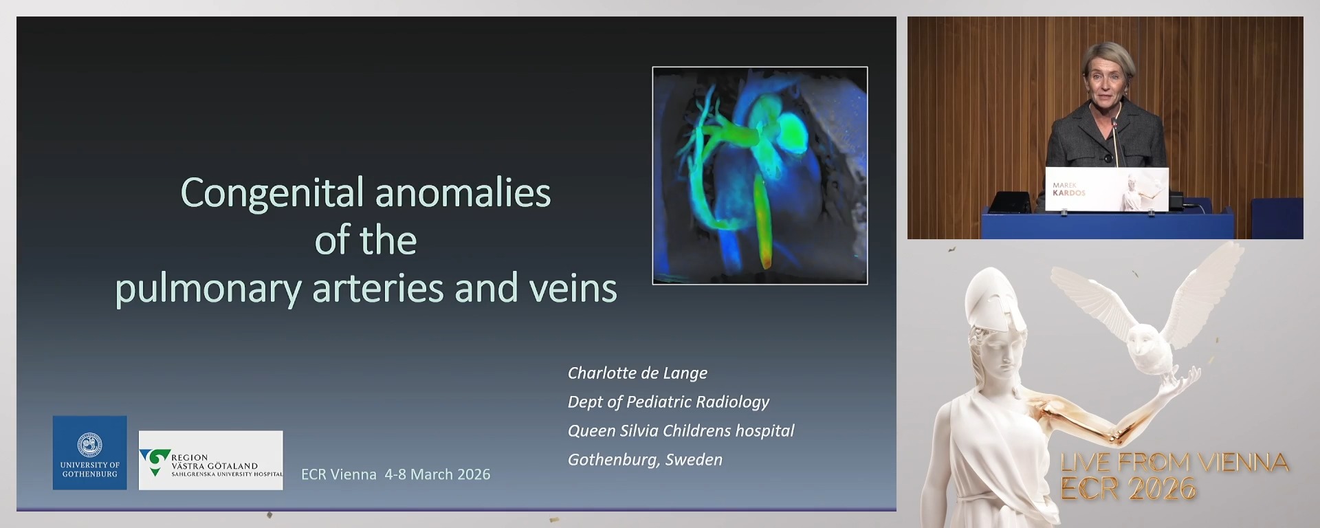 Congenital anomalies of the pulmonary arteries and veins
