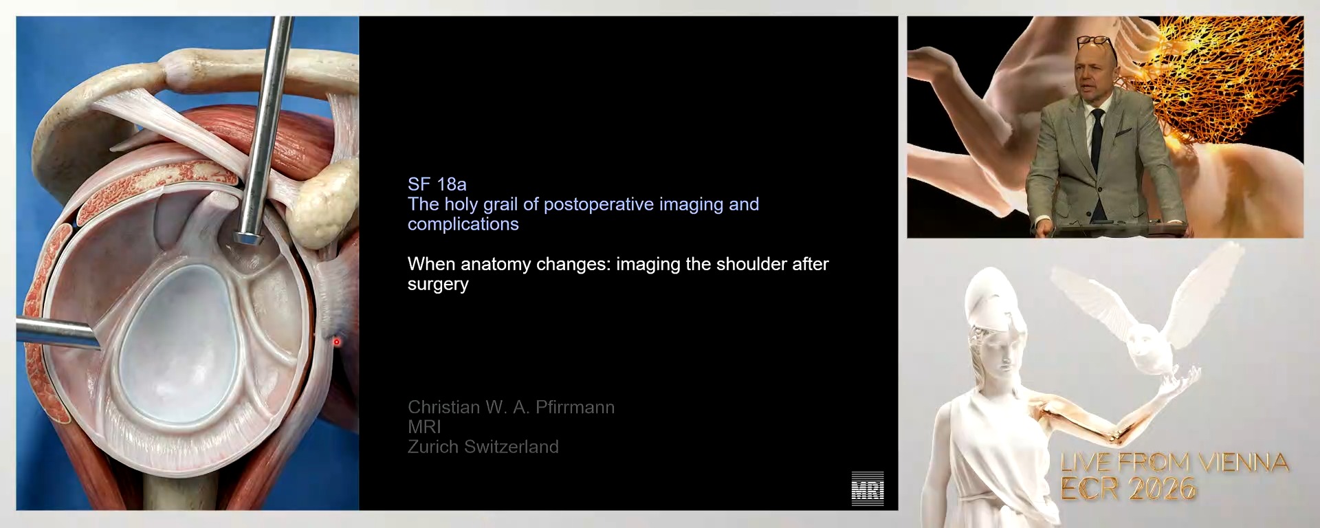 When anatomy changes: imaging the shoulder after surgery