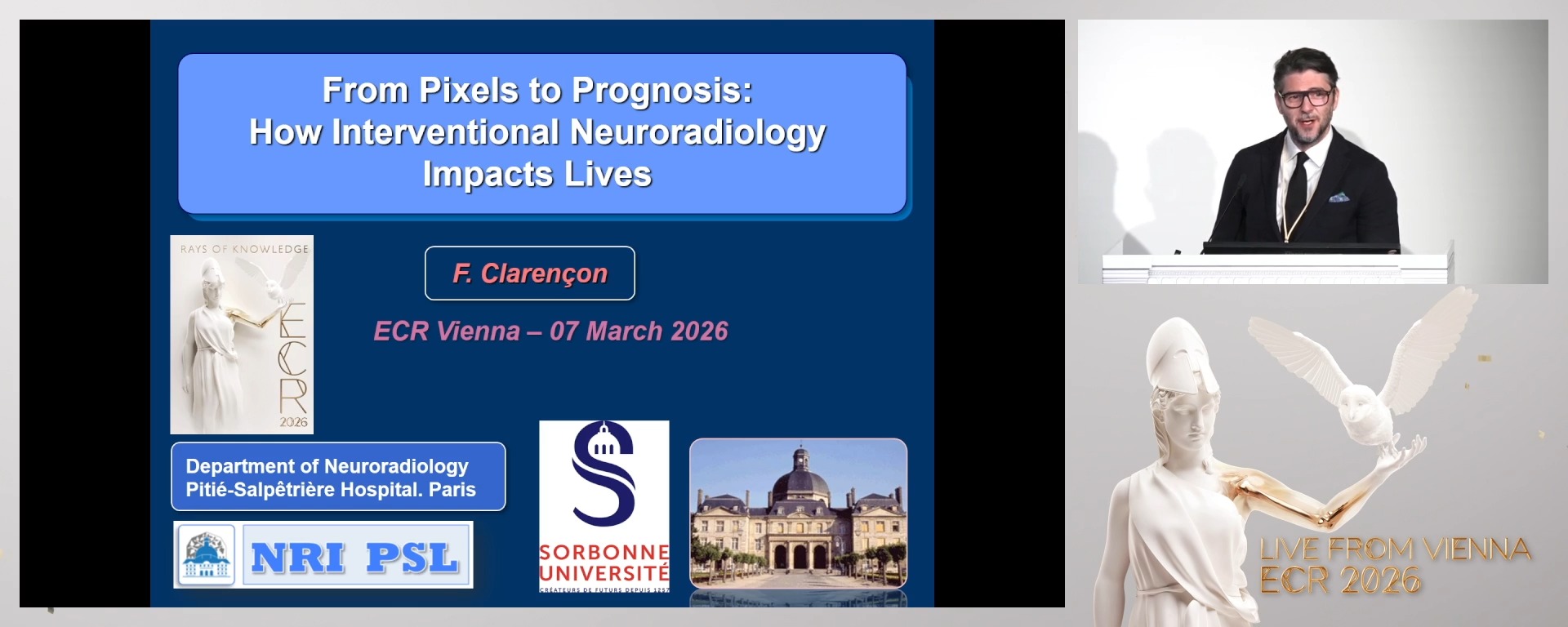 From pixels to prognosis: how interventional neuroradiology impacts lives?