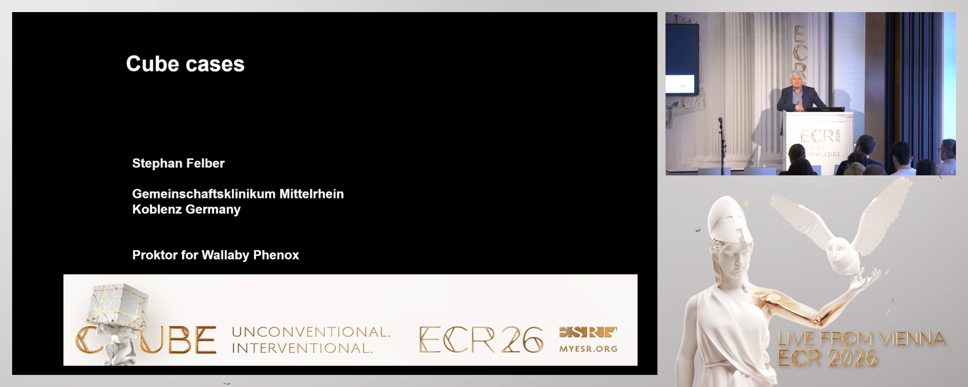 Challenging and unusual cases of ruptured aneuryss and mechanical thrombectomies