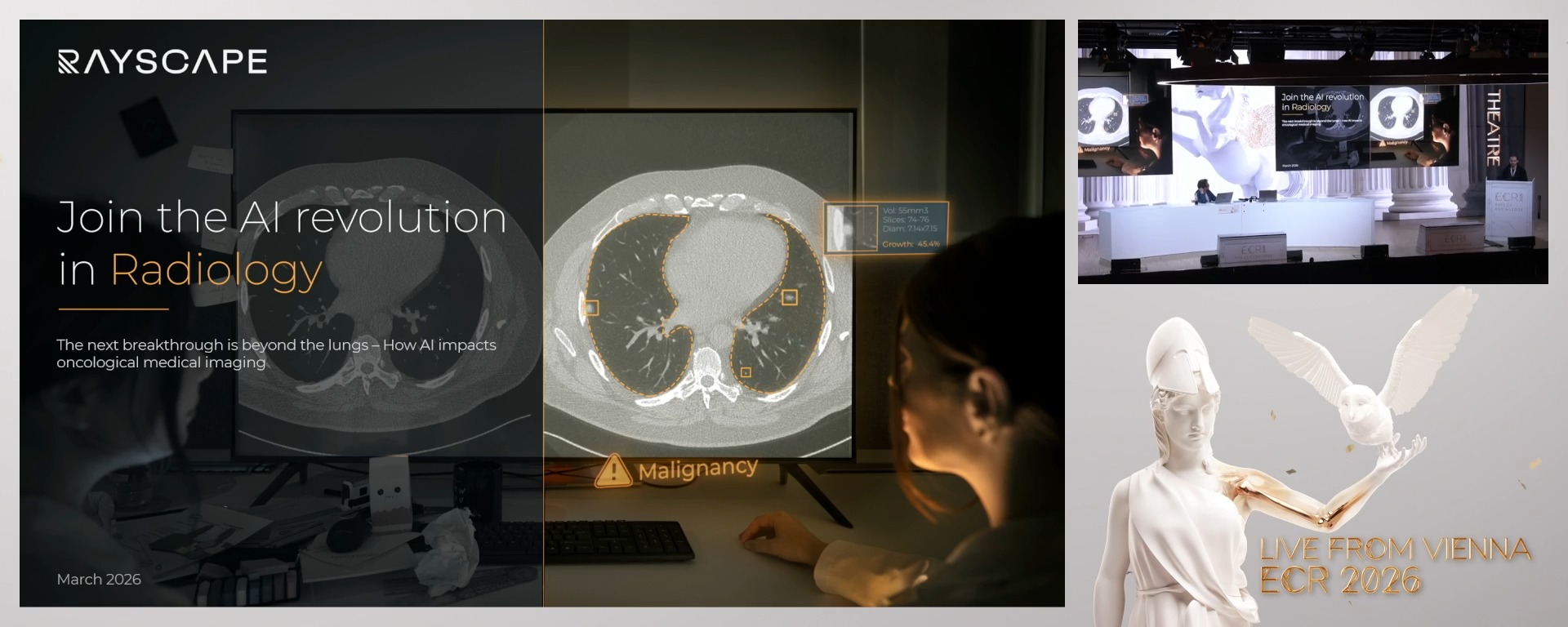 The next breakthrough is beyond the lungs – How can Artificial Intelligence impact oncological medical imaging